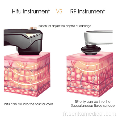 Mini Home User Machine HIFU